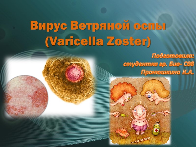 Вирус Ветряной оспы (Varicella Zoster) Подготовила:  студентка гр. Био- С08  Пронюшкина К.А.